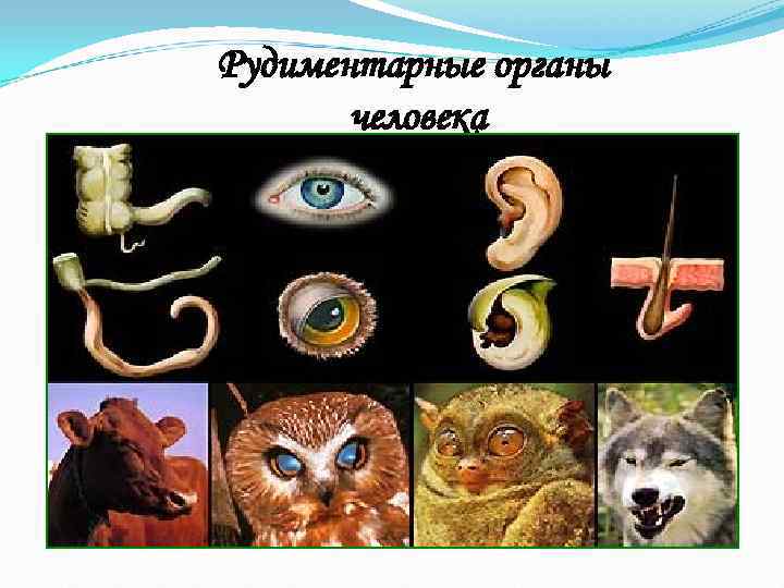 Рудиментарные органы  человека 
