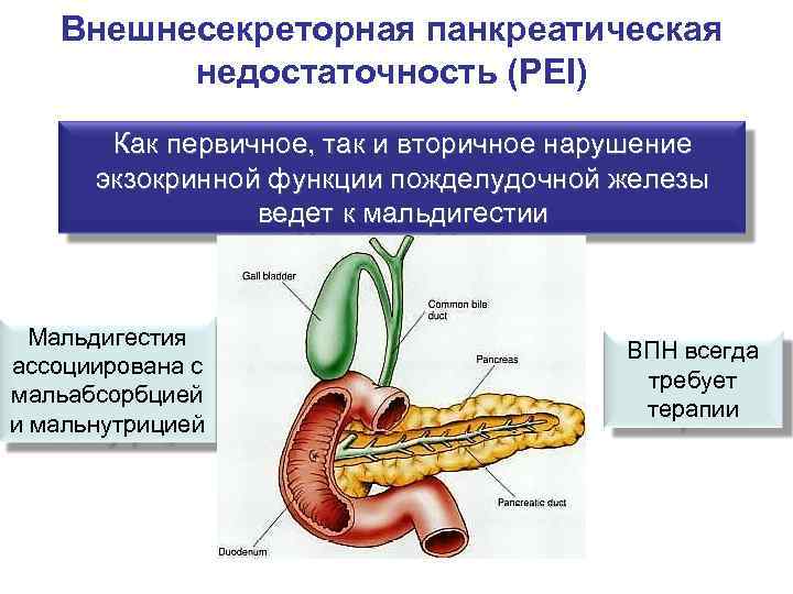   Внешнесекреторная панкреатическая  недостаточность (PEI)  Как первичное, так и вторичное нарушение