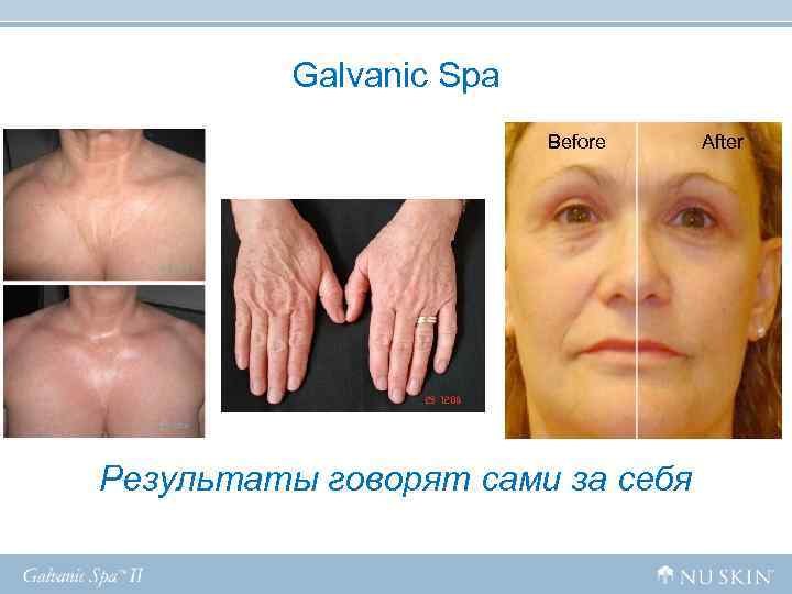 Galvanic Spa Before After Результаты говорят Galvanic Spa Before After Результаты говорят