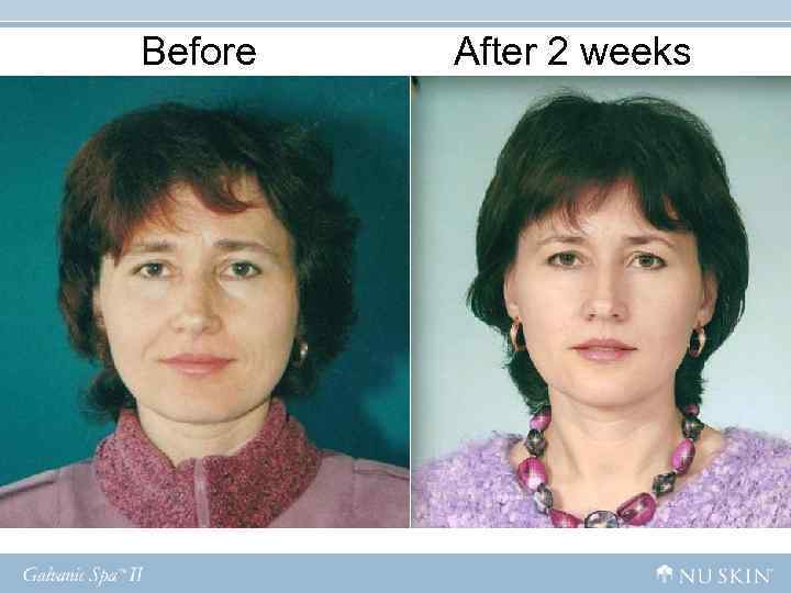 Before After 2 weeks Before After 2 weeks