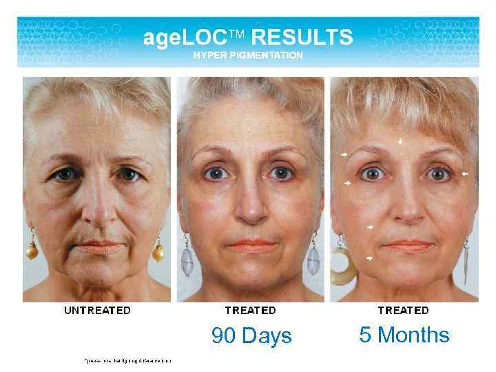 90 Days 5 Months 90 Days 5 Months