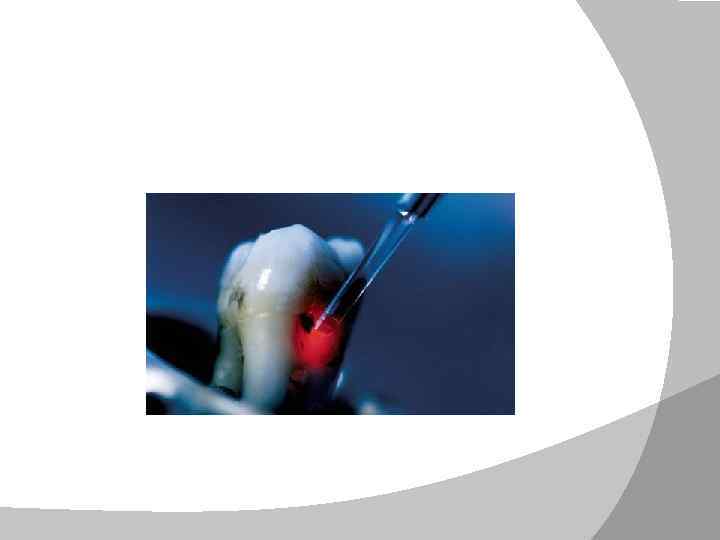 Стоматология да жаңа лазерлік аппаратты қолдану 