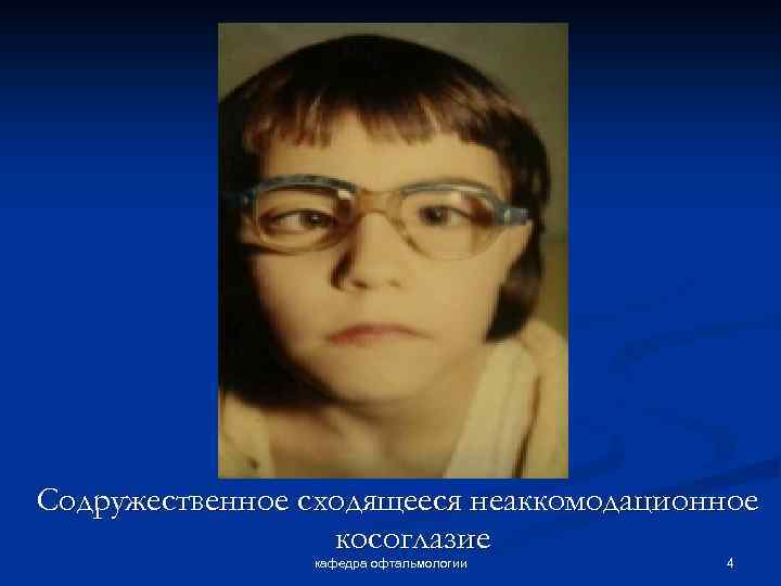 Содружественное сходящееся неаккомодационное косоглазие кафедра офтальмологии 4 