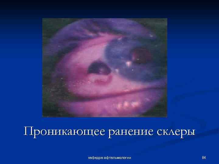 Проникающее ранение склеры кафедра офтальмологии 64 
