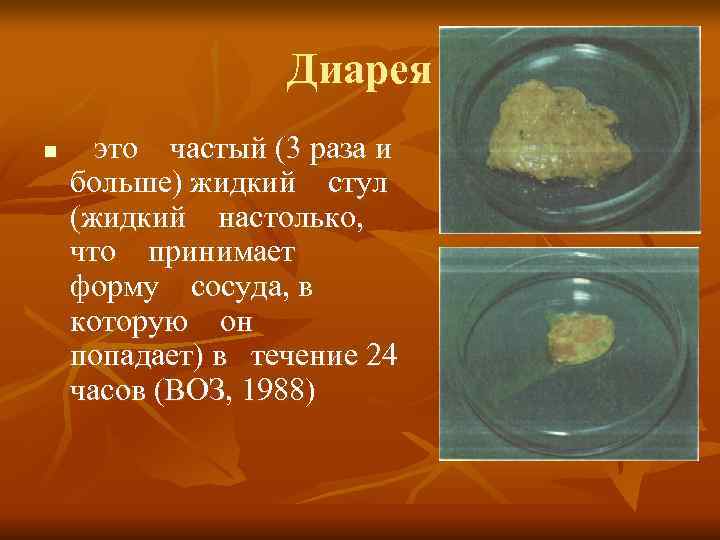      Диарея n это  частый (3 раза и 