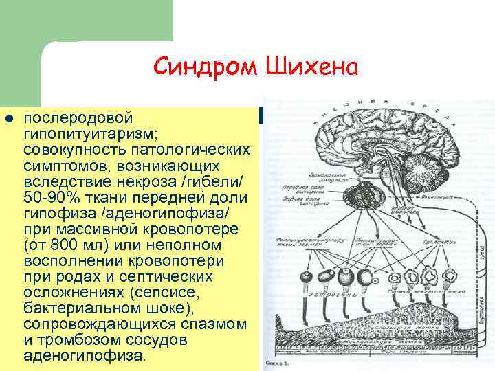     Синдром Шихена l  послеродовой гипопитуитаризм;  совокупность патологических симптомов,