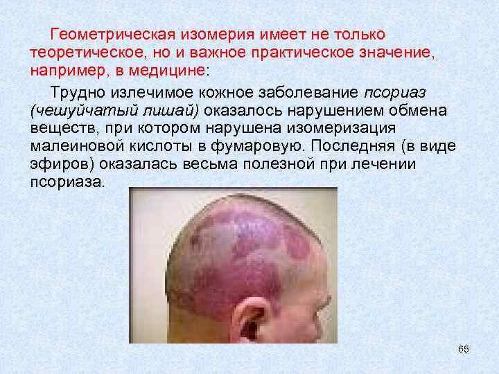   Геометрическая изомерия имеет не только теоретическое, но и важное практическое значение, например,