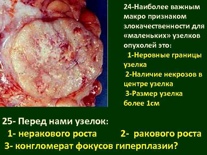     24 -Наиболее важным     макро признаком 