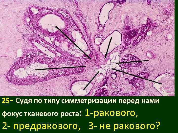 25 - Судя по типу симметризации перед нами фокус тканевого роста:   