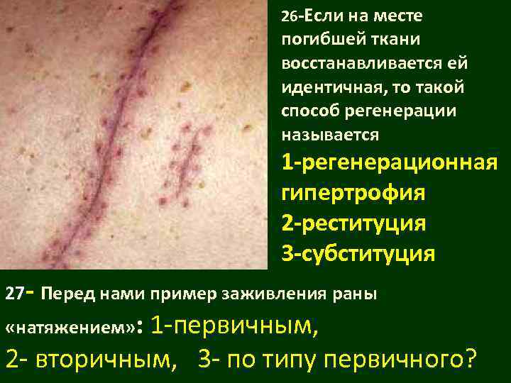       26 -Если на месте    