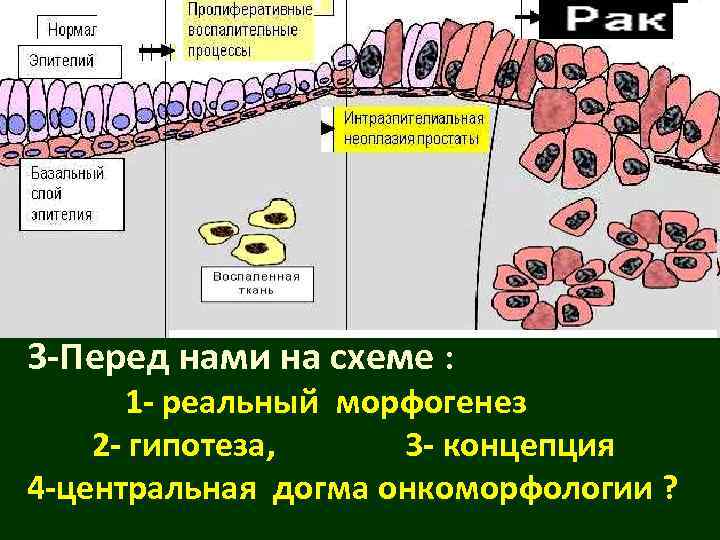 3 -Перед нами на схеме :  1 - реальный морфогенез 2 - гипотеза,