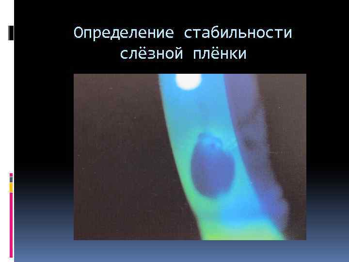 Определение стабильности слёзной плёнки 