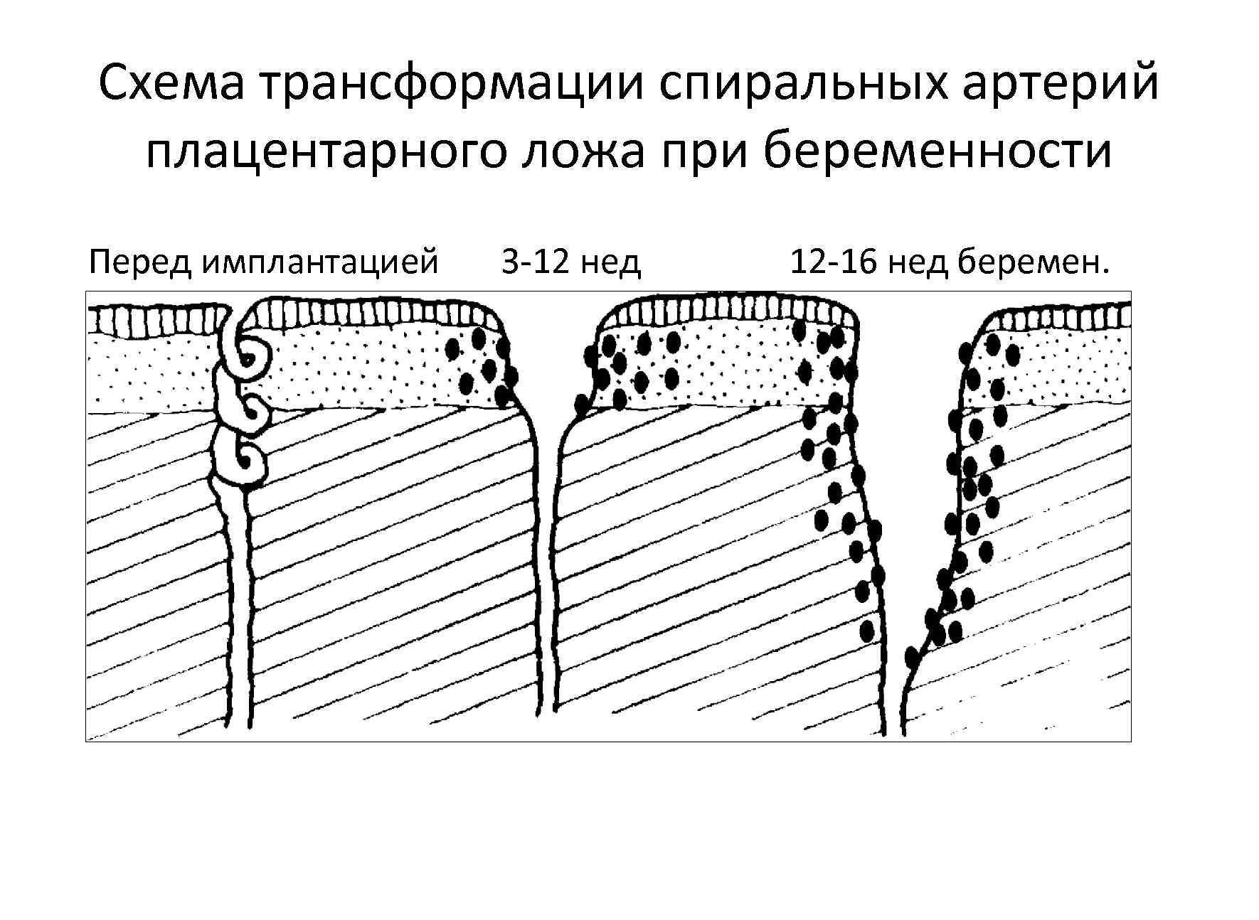 Гестоз 2 половины беременности карта вызова - 87 фото