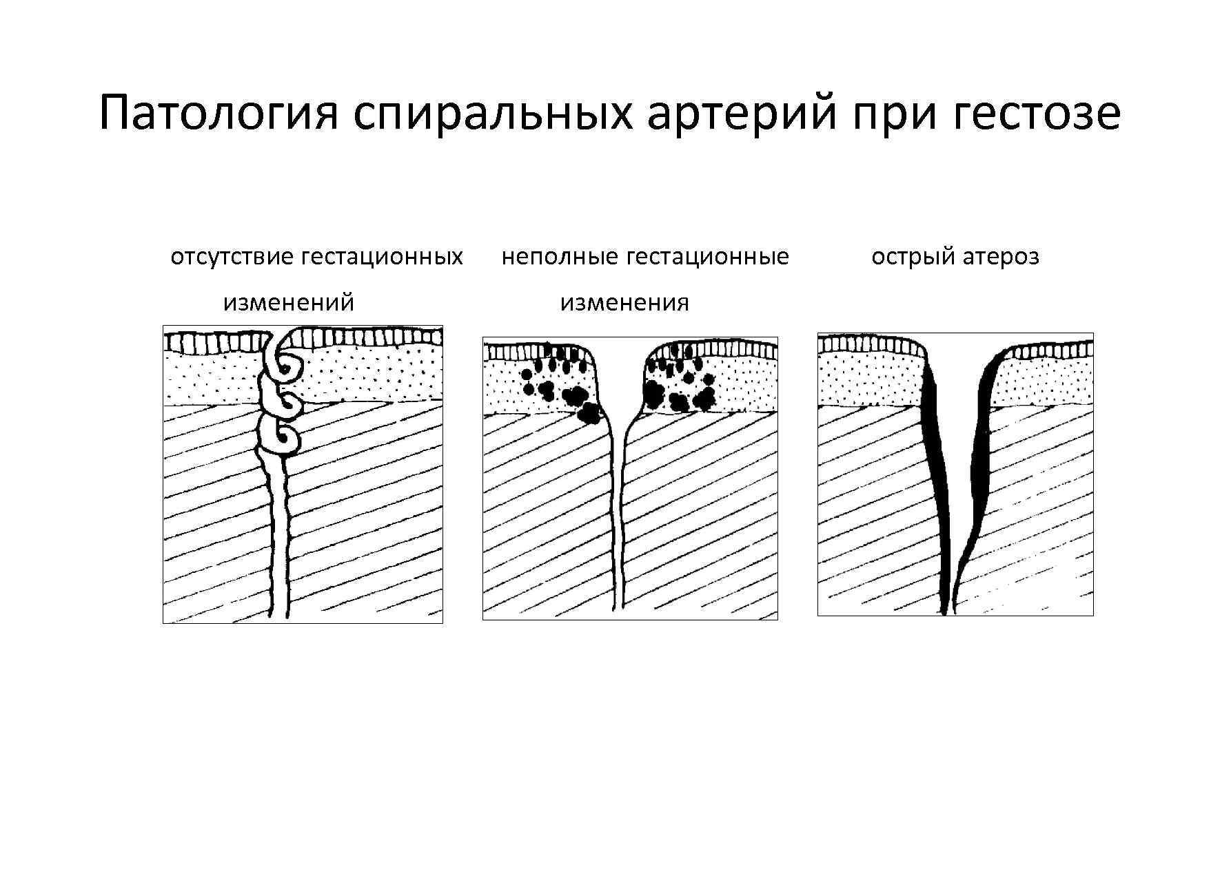 Патология беременности презентация