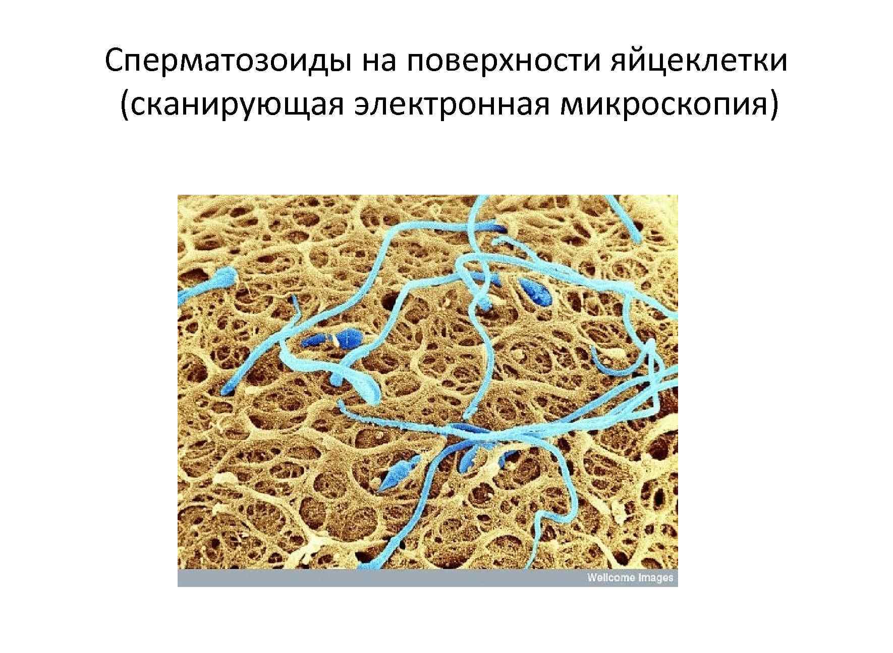 Гестоз 2 половины беременности карта вызова