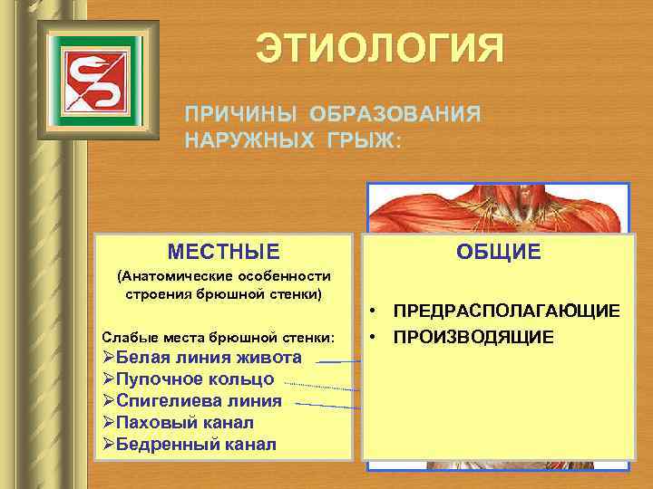    ЭТИОЛОГИЯ   ПРИЧИНЫ ОБРАЗОВАНИЯ   НАРУЖНЫХ ГРЫЖ:  