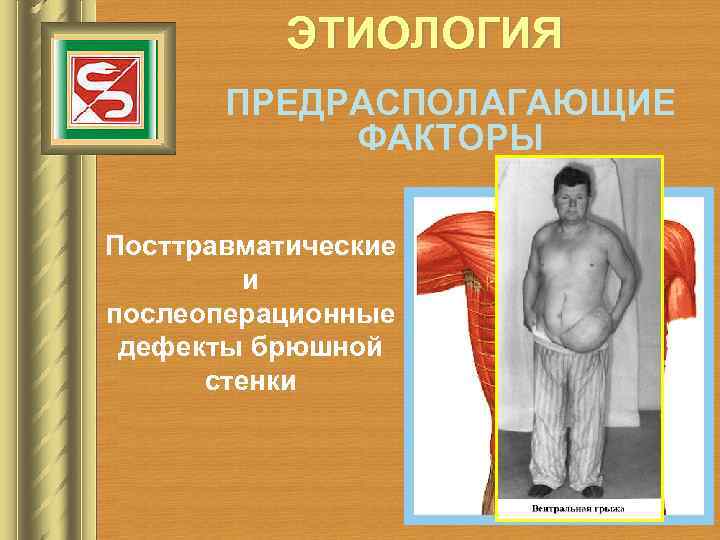   ЭТИОЛОГИЯ  ПРЕДРАСПОЛАГАЮЩИЕ   ФАКТОРЫ Посттравматические   и послеоперационные дефекты