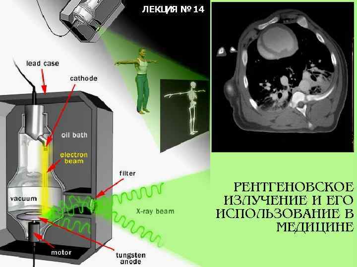 ЛЕКЦ № 14 ИЯ РЕНТГЕНОВСКОЕ ИЗЛУЧЕНИЕ И ЕГО ИСПОЛЬЗОВАНИЕ В МЕДИЦИНЕ 