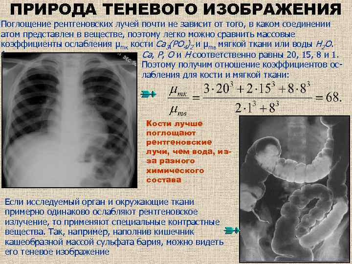 ПРИРОДА ТЕНЕВОГО ИЗОБРАЖЕНИЯ Поглощение рентгеновских лучей почти не зависит от того, в каком соединении