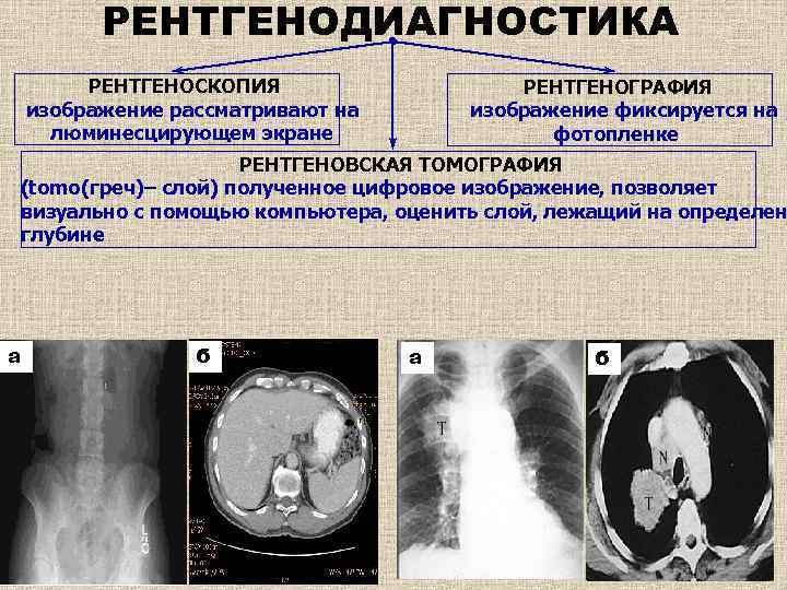 Единица цифрового изображения на рентгенограмме это