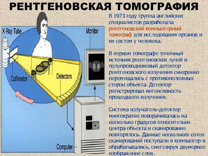 РЕНТГЕНОВСКАЯ ТОМОГРАФИЯ В 1973 году группа английских специалистов разработала рентгеновский компьютерный томограф для исследования