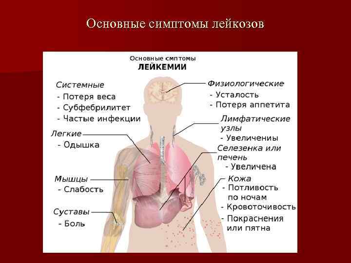 Основные симптомы лейкозов 