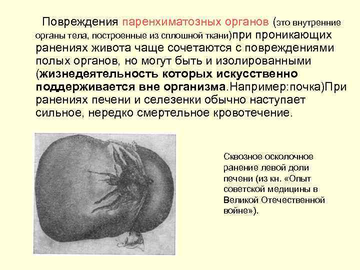 Повреждения паренхиматозных органов (это внутренние органы тела, построенные из сплошной ткани)при проникающих ранениях