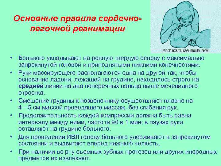 Условиями проведении ивл являются. Порядок проведения СЛР. Порядок сердечно-легочной реанимации. Правила проведения сердечно-легочной реанимации. Правила сердечно легочной реанимации.