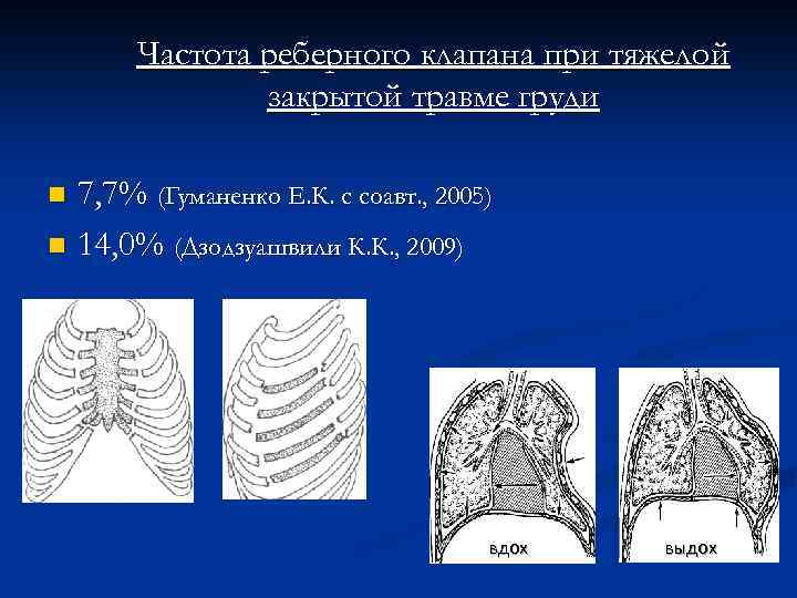 Частота реберного клапана при тяжелой закрытой травме груди 7, 7% (Гуманенко Е. К. с