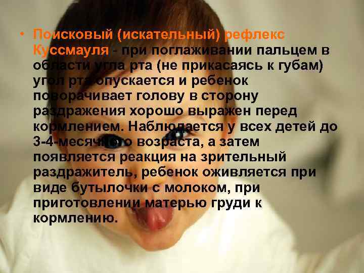  • Поисковый (искательный) рефлекс  Куссмауля - при поглаживании пальцем в  области