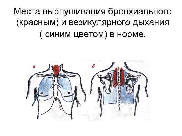 Места выслушивания бронхиального (красным) и везикулярного дыхания ( синим цветом) в норме. 