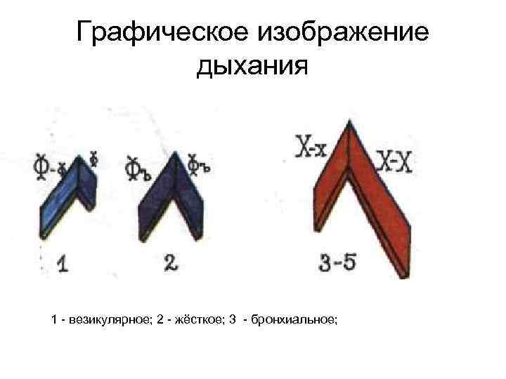   Графическое изображение  дыхания 1  везикулярное; 2  жёсткое; 3 