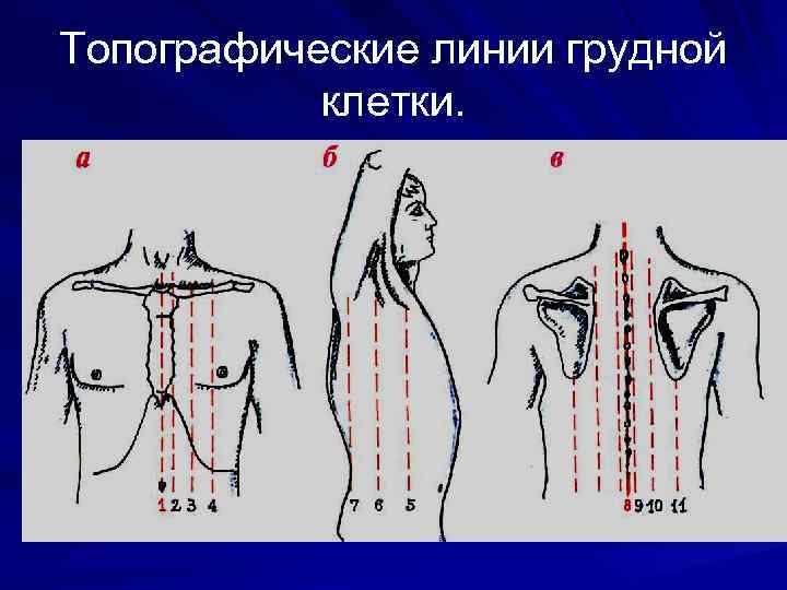 Топографические линии грудной  клетки. 