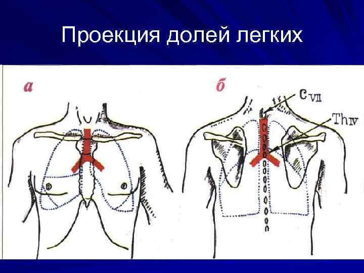 Проекция долей легких 