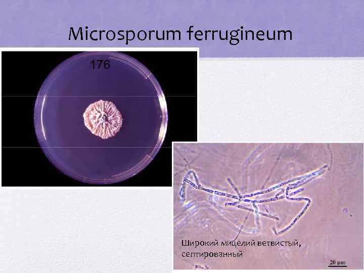 Microsporum ferrugineum Широкий мицелий ветвистый, септированный 