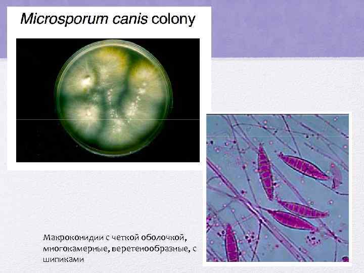 Макроконидии с четкой оболочкой, многокамерные, веретенообразные, с шипиками 