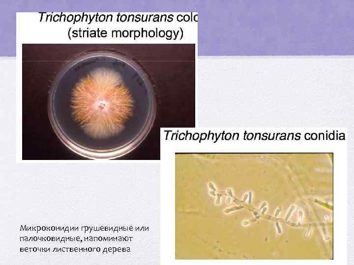 Микроконидии грушевидные или палочковидные, напоминают веточки лиственного дерева 