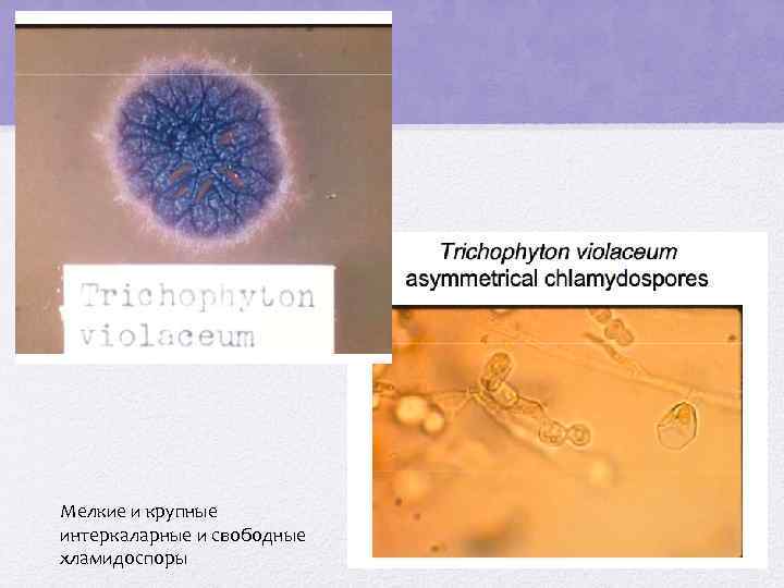 Мелкие и крупные интеркаларные и свободные хламидоспоры 