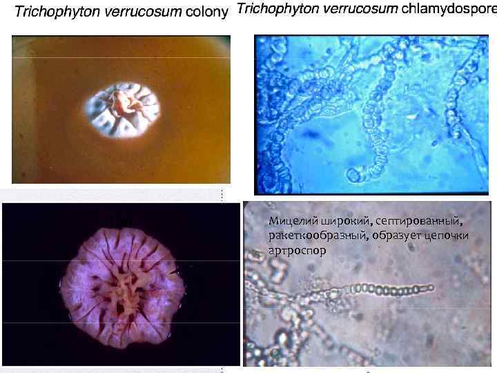 Мицелий широкий, септированный, ракеткообразный, образует цепочки артроспор 