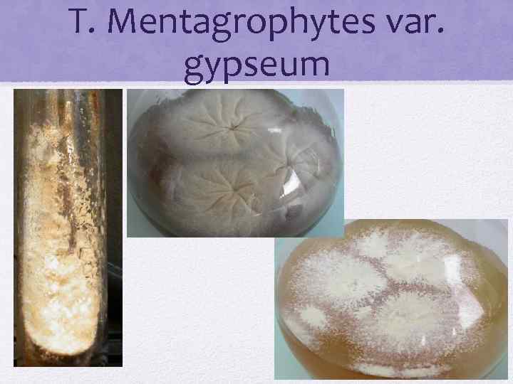 T. Mentagrophytes var. gypseum 