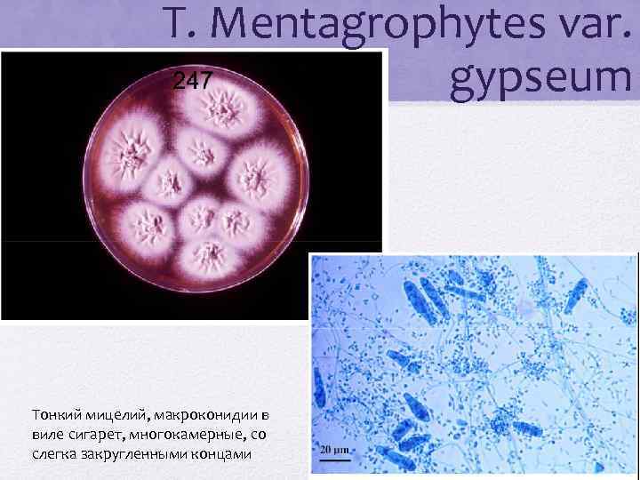 T. Mentagrophytes var. gypseum Тонкий мицелий, макроконидии в виле сигарет, многокамерные, со слегка закругленными