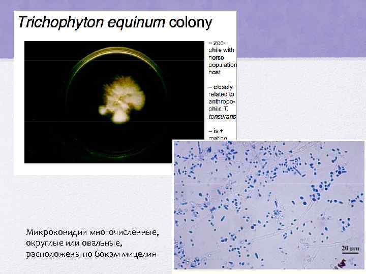 Микроконидии многочисленные, округлые или овальные, расположены по бокам мицелия 