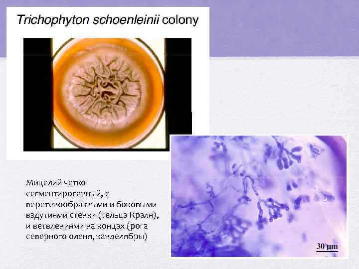 Мицелий четко сегментированный, с веретенообразными и боковыми вздутиями стенки (тельца Краля), и ветвлениями на
