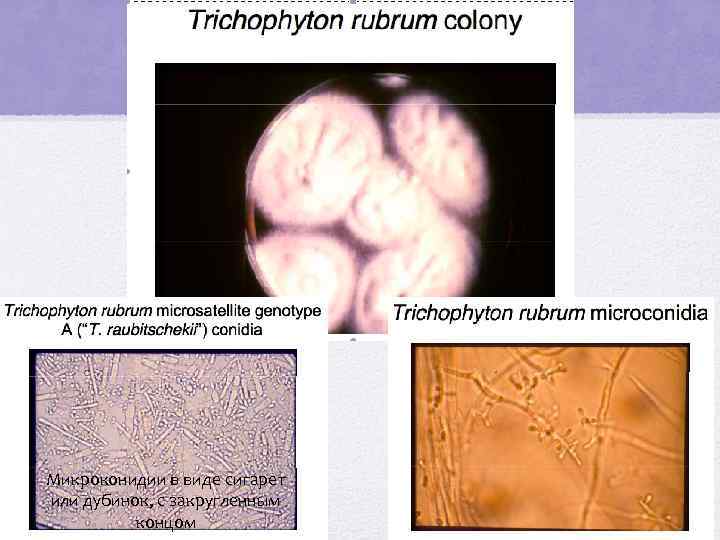 Микроконидии в виде сигарет или дубинок, с закругленным концом 