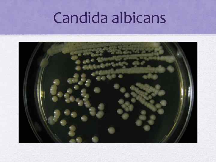  Candida albicans 