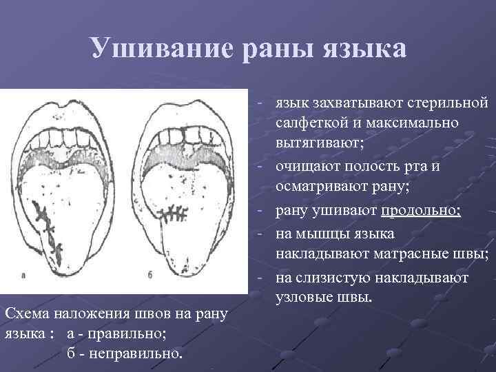 Оперативная хирургия лицевого отдела головы презентация