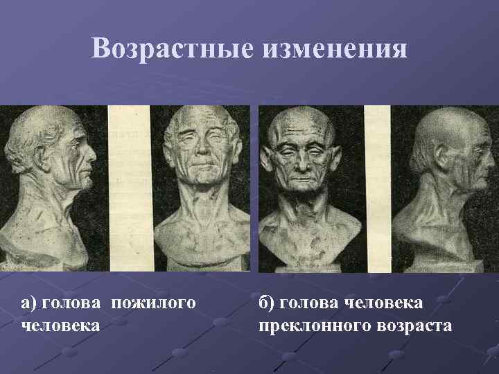 Возрастные изменения а) голова пожилого б) голова человека преклонного Возрастные изменения а) голова пожилого б) голова человека преклонного