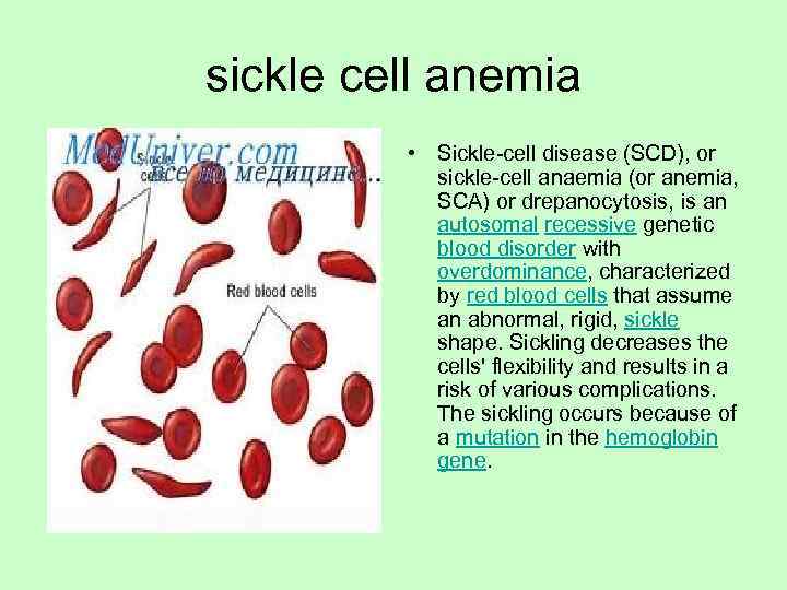 sickle cell anemia  • Sickle-cell disease (SCD), or   sickle-cell anaemia (or