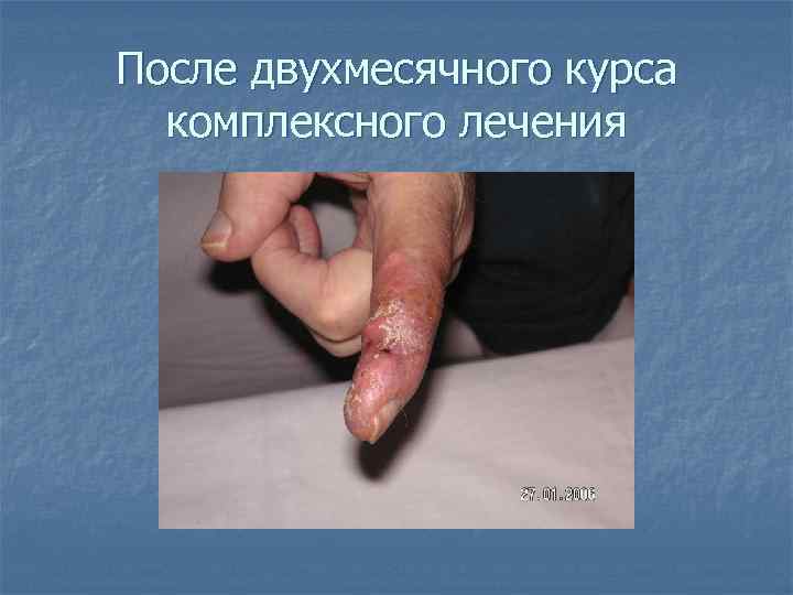 После двухмесячного курса  комплексного лечения 