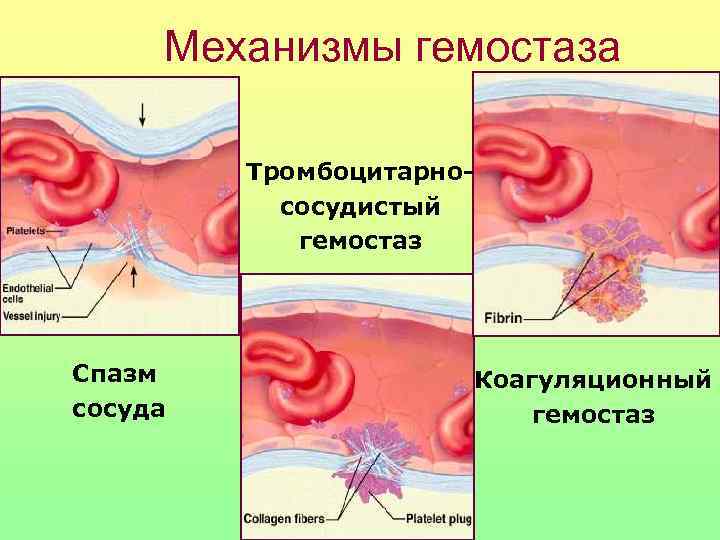  Механизмы гемостаза  Тромбоцитарно-  сосудистый   гемостаз Спазм   Коагуляционный